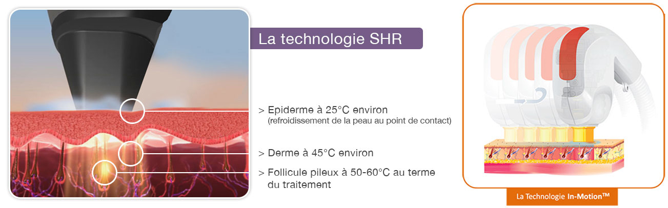 Technologie In-Motion